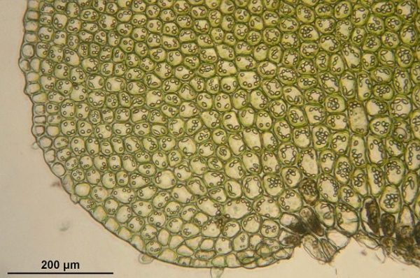 Mikroskopieren - Bazzania Trilobata durch das Mikroskop gesehen