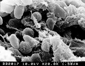 Bakterien der Beulenpest unter dem Elektronenmikroskop