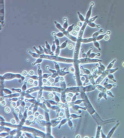 Phasenkontrastaufnahme von Trichoderma harzianum mit sichtbaren Konidiophoren Konidiophoren von Trichoderma harzianum