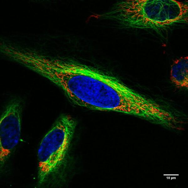 Fluoreszenzbild lebender HeLa-Zellen mit Zellkern, Mitochondrien und Mikrotubuli Konfokales Bild (cLSM) lebender Hela Zellen. Mitochondrien sind rot gefärbt (Mitotracker red), der Zellkern ist blau (DAPI).Das Mikrotubulinetzwerk ist in grün gefärbt (Tubulintracker green). Mitochondrien bilden Netzwerke und werden mittlels Motorproteinen entlang Mikrotubuli transportiert.