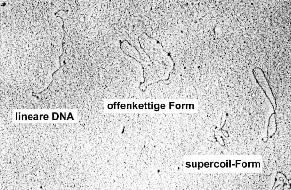TEM-Aufnahme verschiedener DNA-Formen: linear, offen, supercoiled DNA-Strukturen unter dem Transmissionselektronenmikroskop